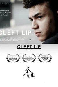  Заячья губа 